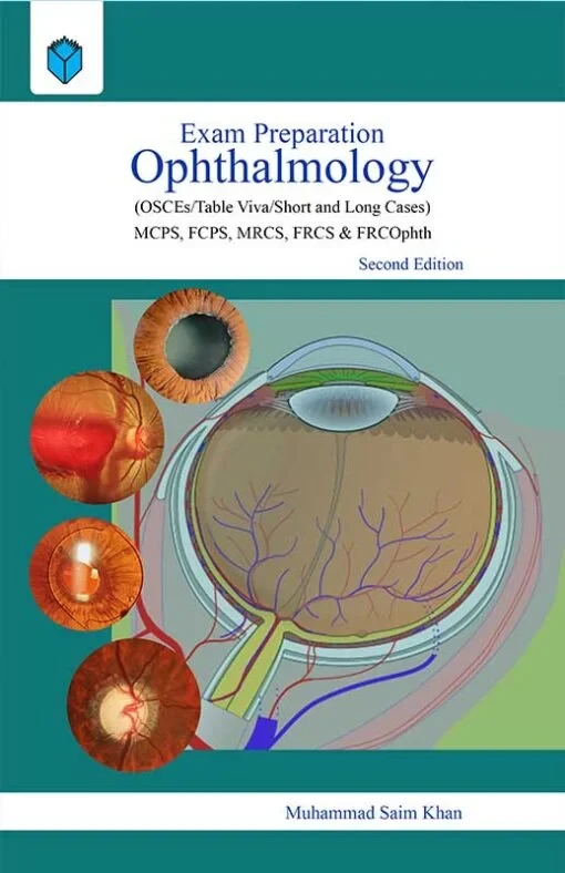 EXAM PREPARATION OPHTHALMOLOGY