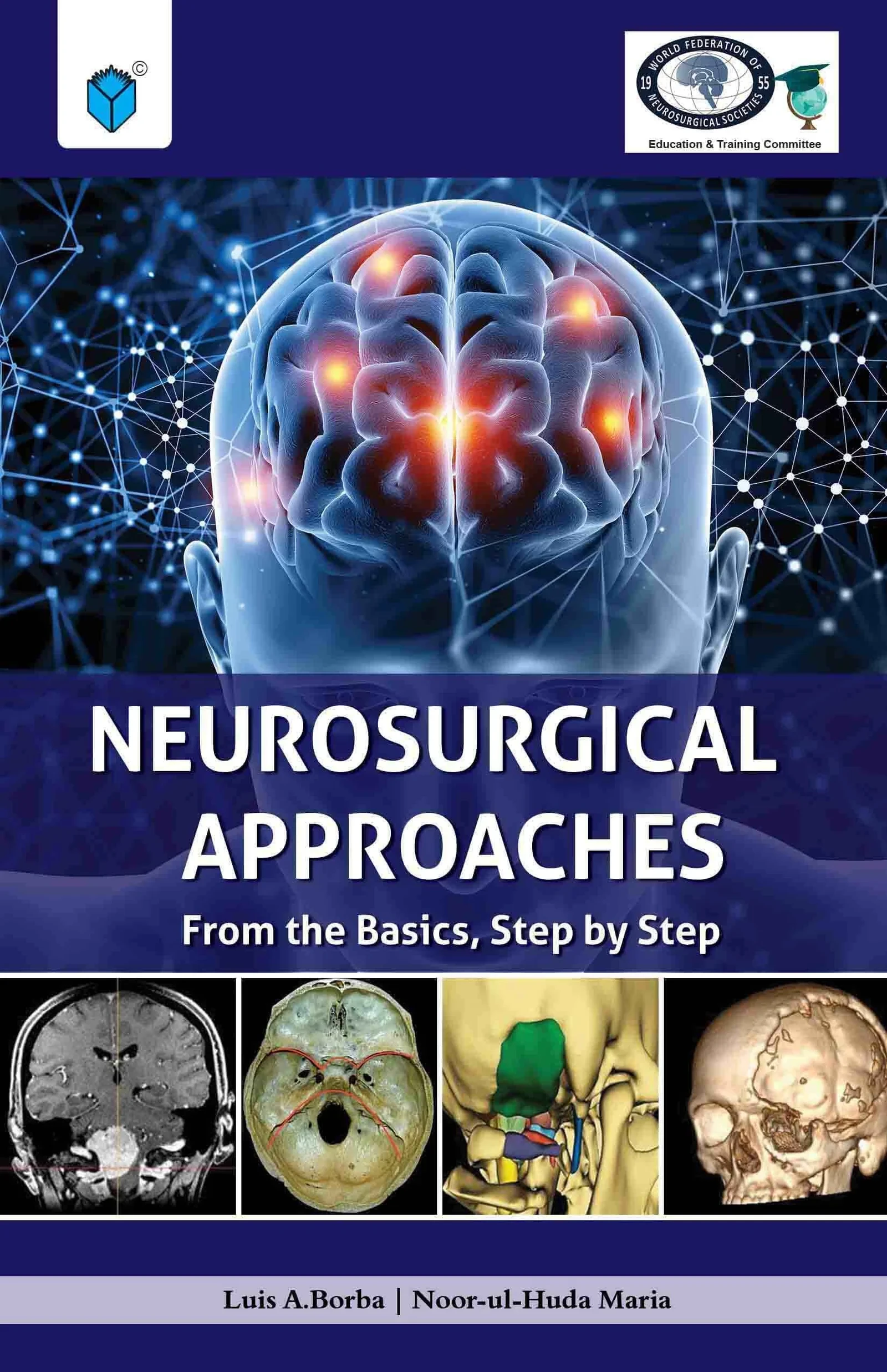 NEUROSURGICAL APPROACHES: FROM THE BASICS, STEP BY STEP